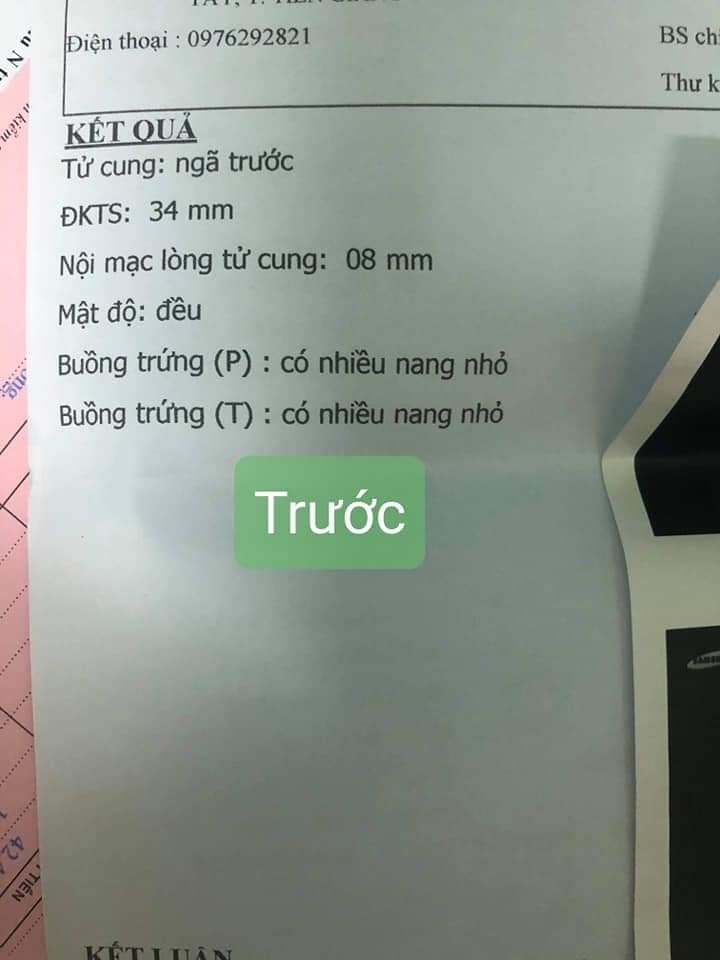 Viêm lộ tuyến có đặt vòng được không?