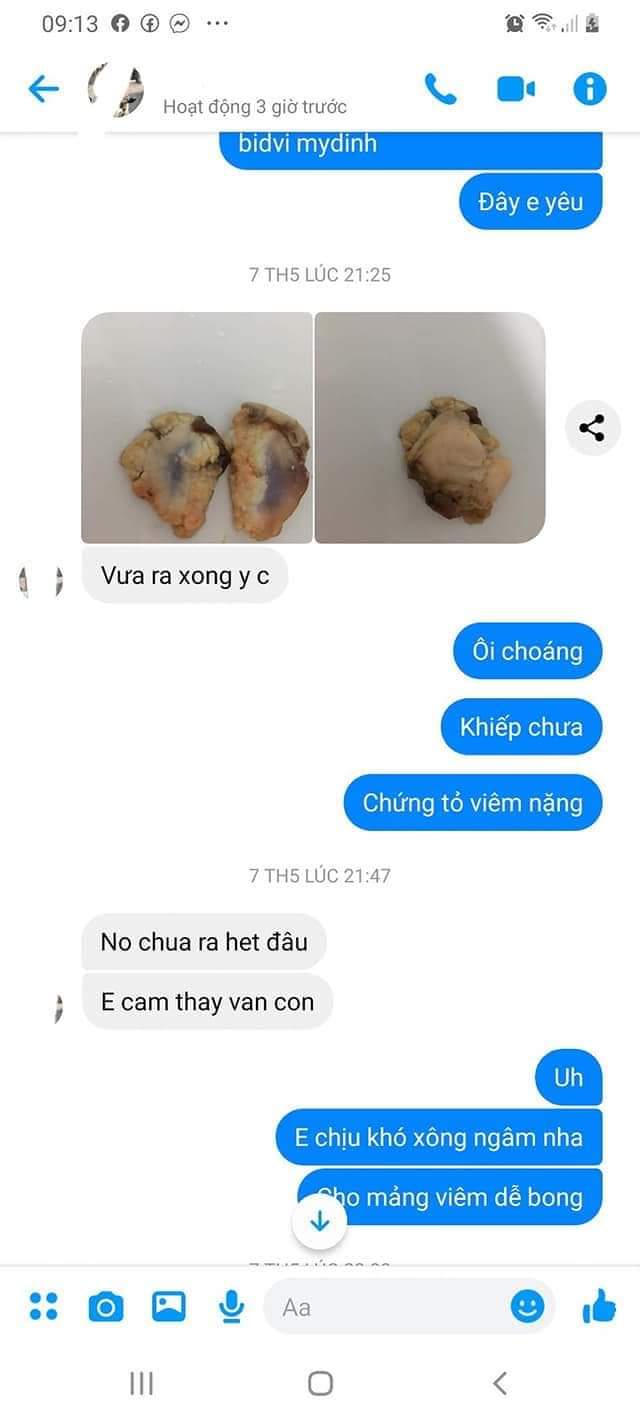 phản hồi