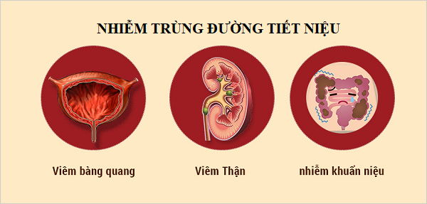 Nguyên nhân đau dạ dày sau quan hệ