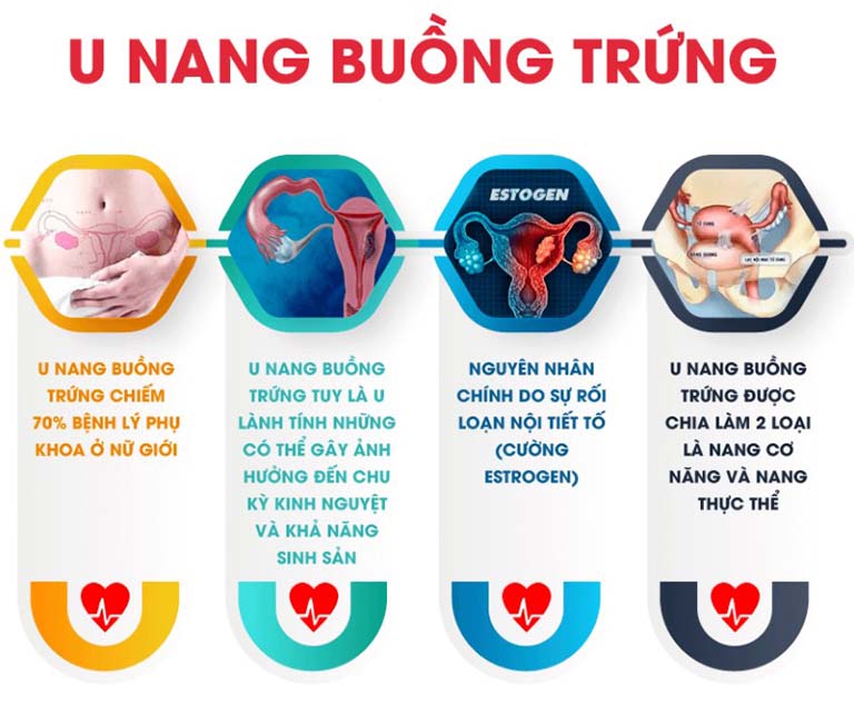 Điều Kinh Hằng Thu hỗ trợ điều trị u nang buồng trứng