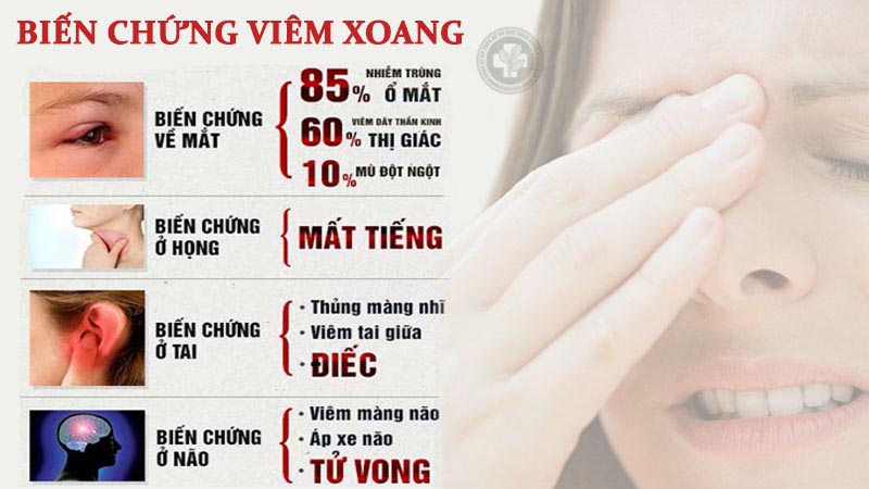 các loại viêm xoang